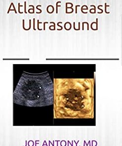 Atlas of breast ultrasound (PDF)