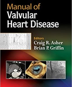 Manual of Valvular Heart Disease (EPUB)