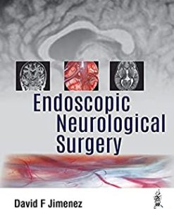 Endoscopic Neurological Surgery (PDF)