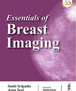 Essentials Of Breast Imaging (PDF)