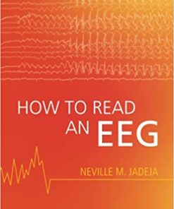 How to Read an EEG (PDF)