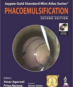 Phacoemulsification (Jaypee Gold Standard Mini Atlas) (PDF)