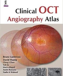 Clinical OCT Angiography Atlas (PDF)