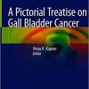A Pictorial Treatise on Gall Bladder Cancer (PDF)