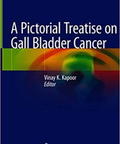 A Pictorial Treatise on Gall Bladder Cancer (PDF)