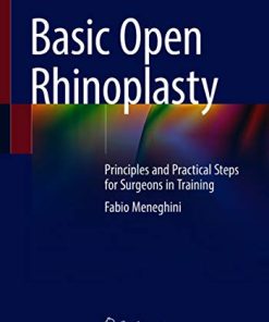 Basic Open Rhinoplasty: Principles and Practical Steps for Surgeons in Training (PDF)