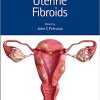 Uterine Fibroids (Reproductive Medicine and Assisted Reproductive Techniques) (PDF Book+VIDEOS)