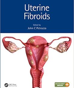 Uterine Fibroids (Reproductive Medicine and Assisted Reproductive Techniques) (PDF Book+VIDEOS)