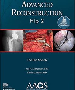 Advanced Reconstruction Hip 2 (PDF)