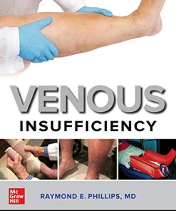 Venous Insufficiency (PDF)