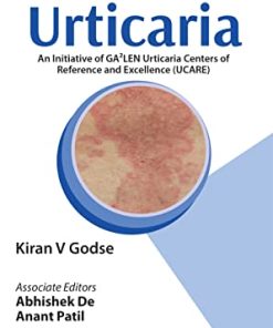 Handbook of Urticaria (PDF)