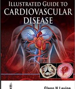 Illustrated Guide to Cardiovascular Disease (PDF)