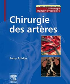 Chirurgie des artères: Pilon Partiel 15/2/16 (PDF)