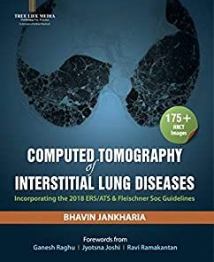 Computed Tomography of Interstitial Lung Diseases (PDF)