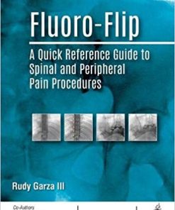 Fluoro-Flip: A Quick Reference Guide to Spinal and Peripheral Pain Procedures (PDF)