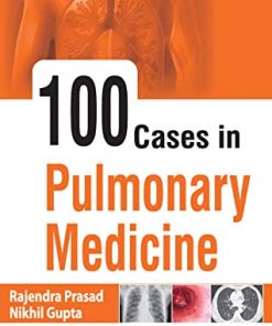 100 Cases in Pulmonary Medicine (PDF)