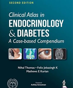 Clinical Atlas in Endocrinology & Diabetes: A Case-based Compendium, 2nd Edition (PDF)