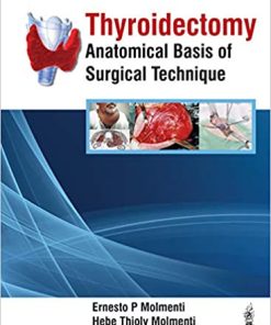 Thyroidectomy: Anatomical Basis of Surgical Technique (PDF)