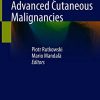 New Therapies in Advanced Cutaneous Malignancies (PDF)