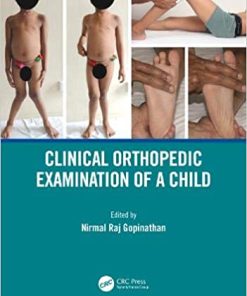 Clinical Orthopedic Examination of a Child (PDF)