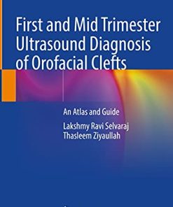 First and Mid Trimester Ultrasound Diagnosis of Orofacial Clefts: An Atlas and Guide (PDF)