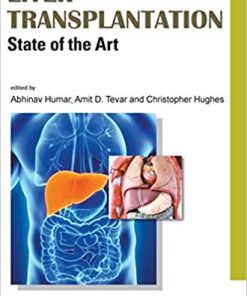 Liver Transplantation: State of the Art (PDF)