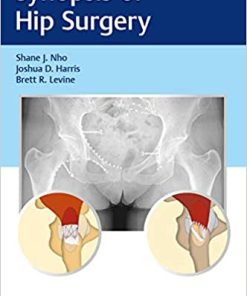 Synopsis of Hip Surgery (PDF)