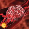 Thrombosis & Thromboembolism 2022 (CME VIDEOS)