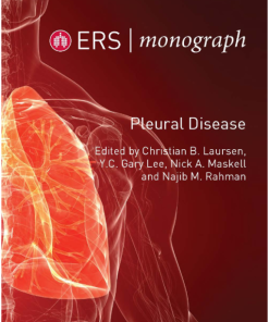 ERS Monograph 87: Pleural Disease (PDF)