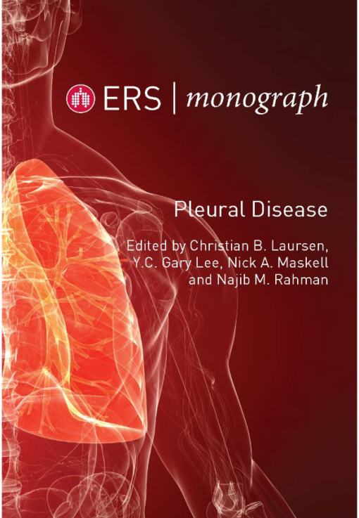 ERS Monograph 87: Pleural Disease (PDF) ERS Monograph 87: Pleural Disease (PDF)