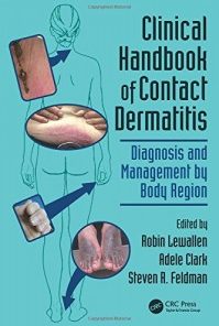 Clinical Handbook of Contact Dermatitis: Diagnosis and Management by Body Region