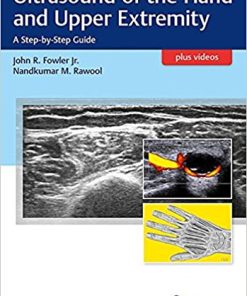 Ultrasound of the Hand and Upper Extremity: A Step-by-Step Guide (PDF Book + Videos)