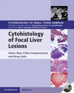 Cytohistology of Focal Liver Lesions