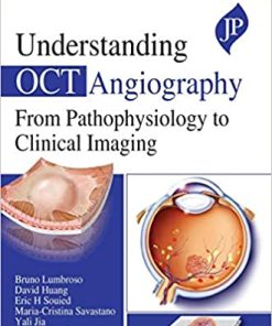 Understanding OCT Angiography from Pathophysiology to Clinical Imaging (PDF)