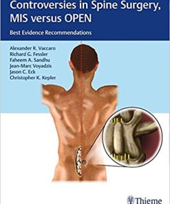 Controversies in Spine Surgery, MIS versus OPEN: Best Evidence Recommendations (EPUB)