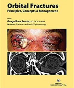 Orbital Fractures: Principles, Concepts & Managements (azw3+ePub+Converted PDF)