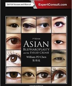 Asian Blepharoplasty and the Eyelid Crease, 3rd Edition (PDF)