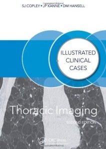 Thoracic Imaging: Illustrated Clinical Cases, Second Edition