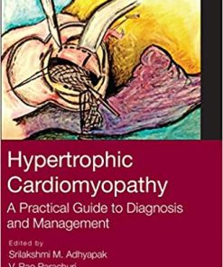 Hypertrophic Cardiomyopathy: A Practical Guide to Diagnosis and Management (PDF)