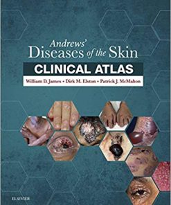 Andrews’ Diseases of the Skin Clinical Atlas (PDF)