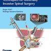 Essential Step-by-Step Techniques for Minimally Invasive Spinal Surgery (PDF Book+Videos)