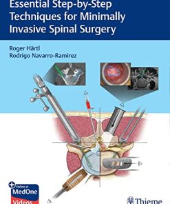 Essential Step-by-Step Techniques for Minimally Invasive Spinal Surgery (PDF Book+Videos)