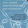 Handbook of Prostate Cancer and Other Genitourinary Malignancies (EPUB)