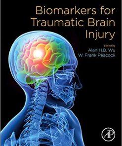 Biomarkers for Traumatic Brain Injury (PDF)