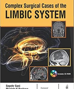 Complex Surgical Cases of the Limbic System (PDF)