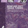 Bone and Soft Tissue Tumours: A Multidisciplinary Review With Case Presentations