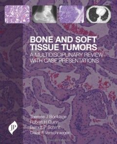 Bone and Soft Tissue Tumours: A Multidisciplinary Review With Case Presentations