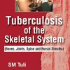 Tuberculosis Of The Skeletal System (Bones, Joints, Spine And Bursal Sheaths) (PDF)