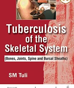 Tuberculosis Of The Skeletal System (Bones, Joints, Spine And Bursal Sheaths) (PDF)