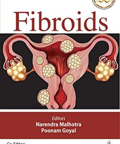 Fibroids (PDF)